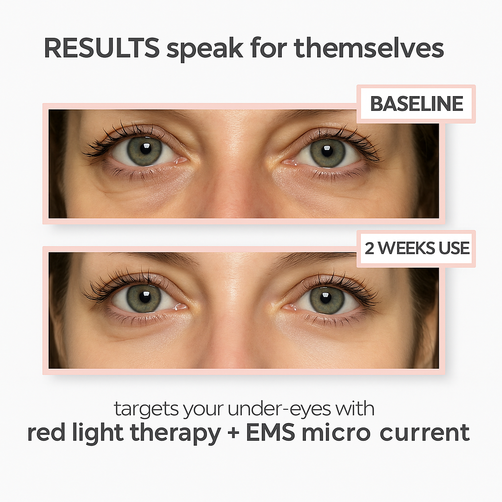 LumaEye Under Eye Rejuvenation