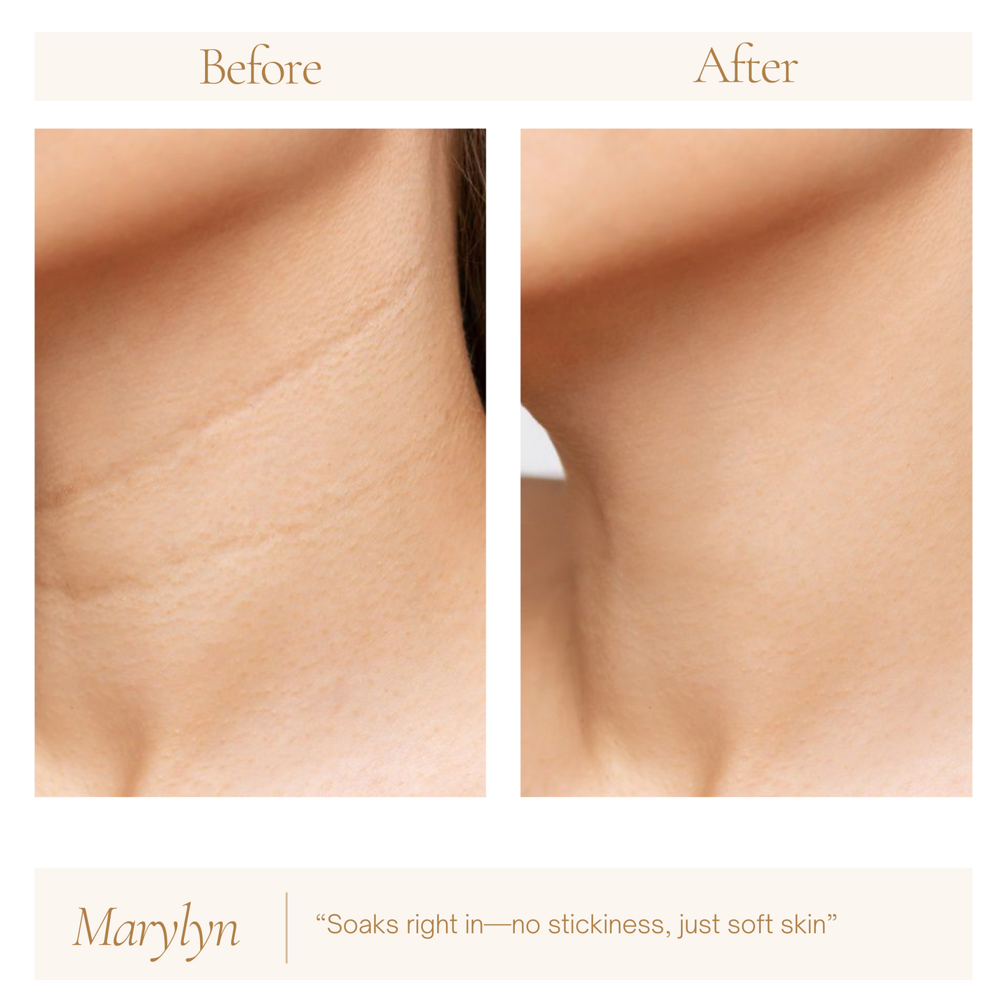 Hyaluronic Acid Serum