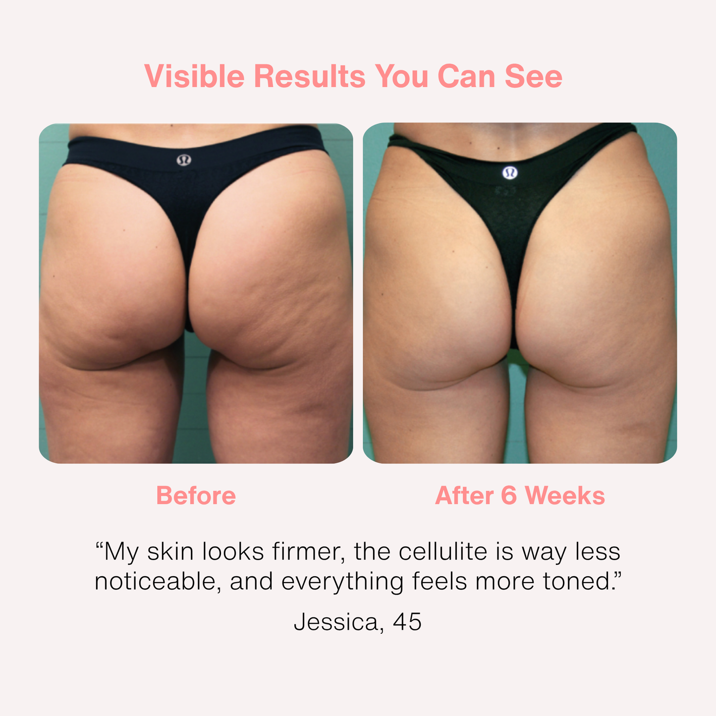 SkinSculpt+ Kit